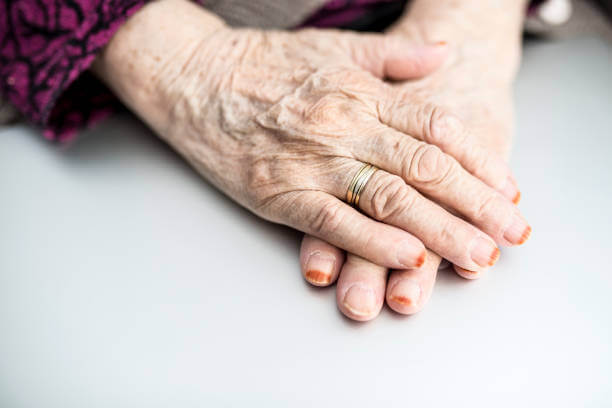 Aging Hands Treatment
