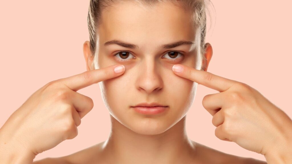 Dark Circles Removal Treatment Dark Circles Removal