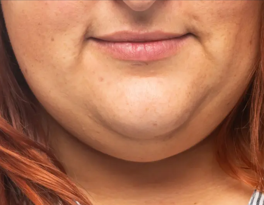 10 Effective Double Chin Exercises You Can Do at Home double chin exercises